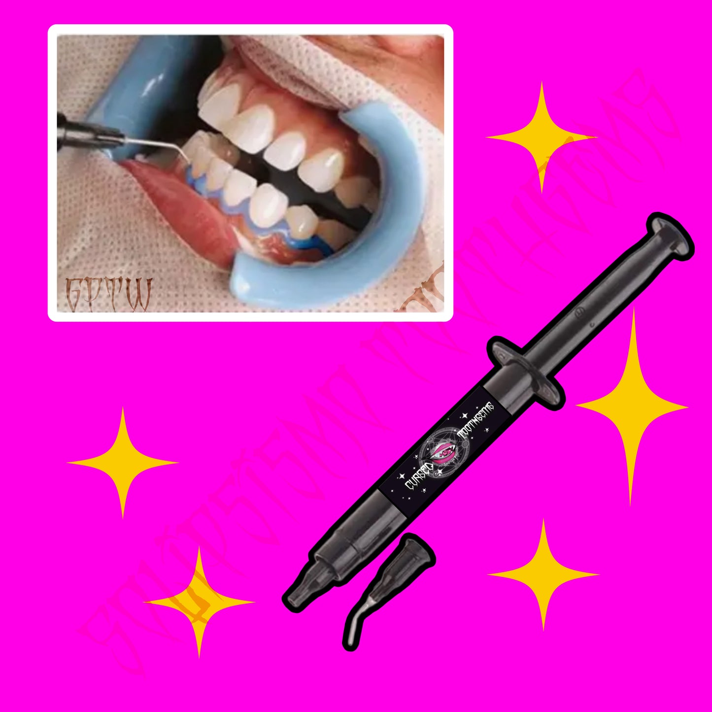 ✨GINGIVAL PROTECTOR ✨